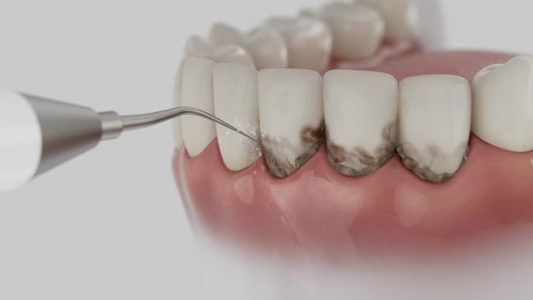Trusted Teeth Cleaning And Checkup service in Towson, MD - Dentist Open Now